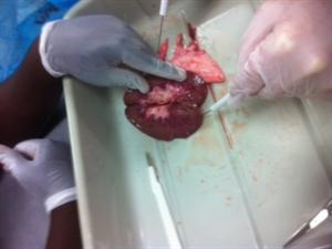 Kidney Dissection 